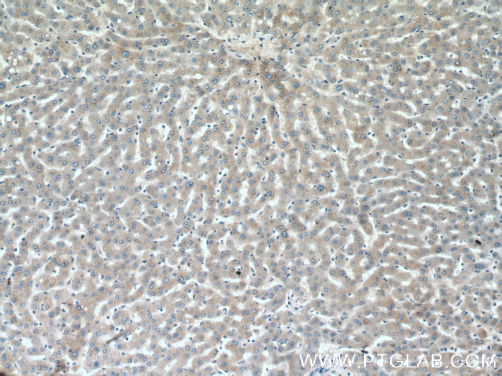 IHC staining of human liver using 27722-1-AP