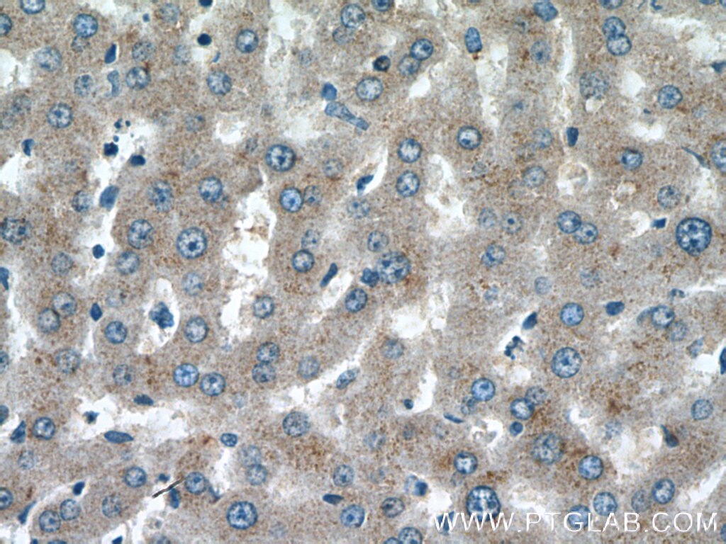 Immunohistochemistry (IHC) staining of human liver tissue using ABCG5 Polyclonal antibody (27722-1-AP)