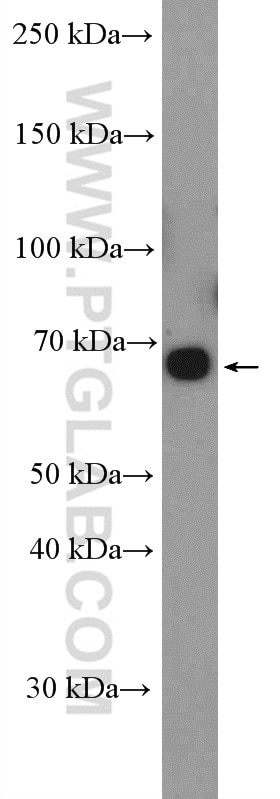 Western Blot (WB) analysis of HepG2 cells using ABCG5 Polyclonal antibody (27722-1-AP)