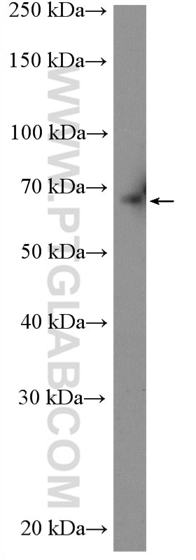 Western Blot (WB) analysis of mouse colon tissue using ABCG5 Polyclonal antibody (27722-1-AP)