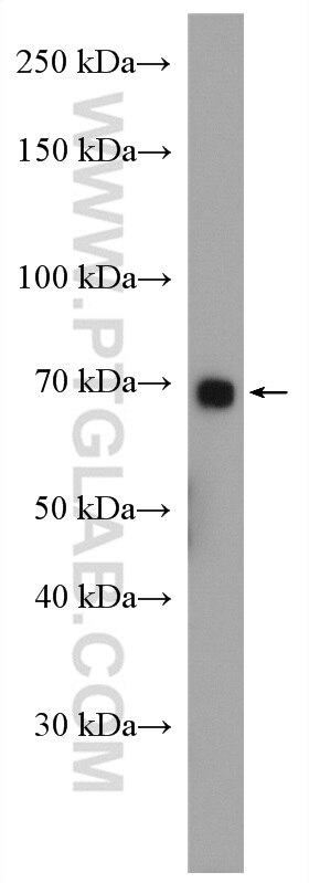 Western Blot (WB) analysis of mouse liver tissue using ABCG5 Polyclonal antibody (27722-1-AP)