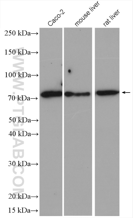 Western Blot (WB) analysis of various lysates using ABCG5 Polyclonal antibody (27722-1-AP)