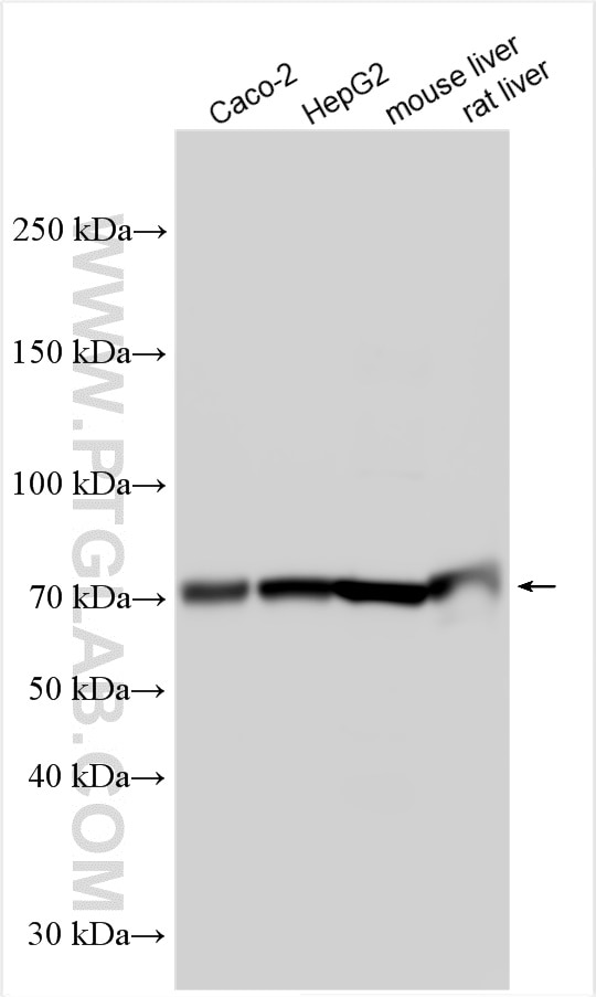 Western Blot (WB) analysis of various lysates using ABCG5 Polyclonal antibody (27722-1-AP)