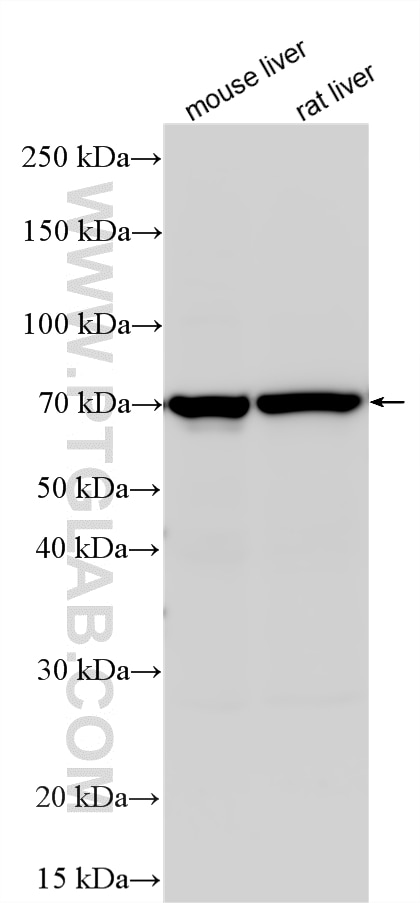 Various lysates were subjected to SDS PAGE followed by western blot with 27722-1-AP (ABCG5 antibody) at dilution of 1:1000 incubated at room temperature for 1.5 hours. Western Blot (WB) analysis of various lysates using ABCG5 Polyclonal antibody (27722-1-AP)
