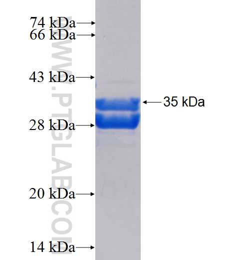 ABCG5 fusion protein Ag26844 SDS-PAGE