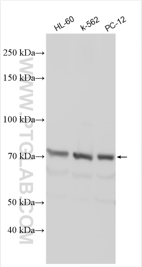 Western Blot (WB) analysis of various lysates using ABCG8 Polyclonal antibody (24453-1-AP)