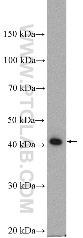 Western Blot (WB) analysis of mouse heart tissue using ABHD1 Polyclonal antibody (26091-1-AP)