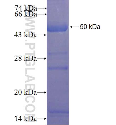 ABHD1 fusion protein Ag23138 SDS-PAGE
