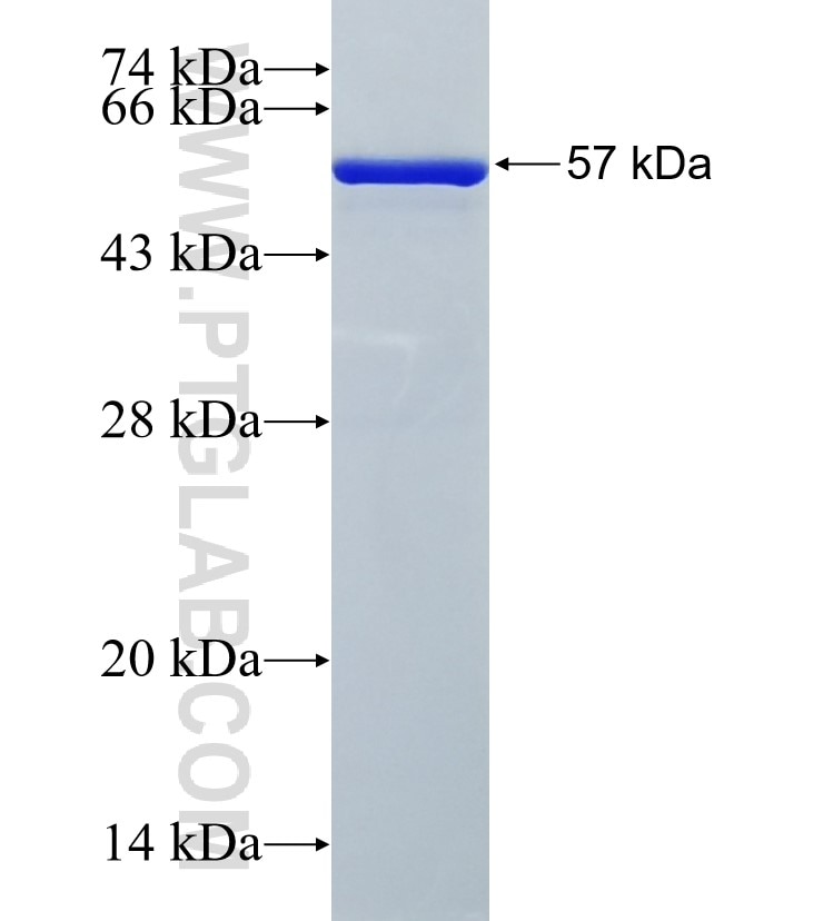 ABHD10 fusion protein Ag18413 SDS-PAGE