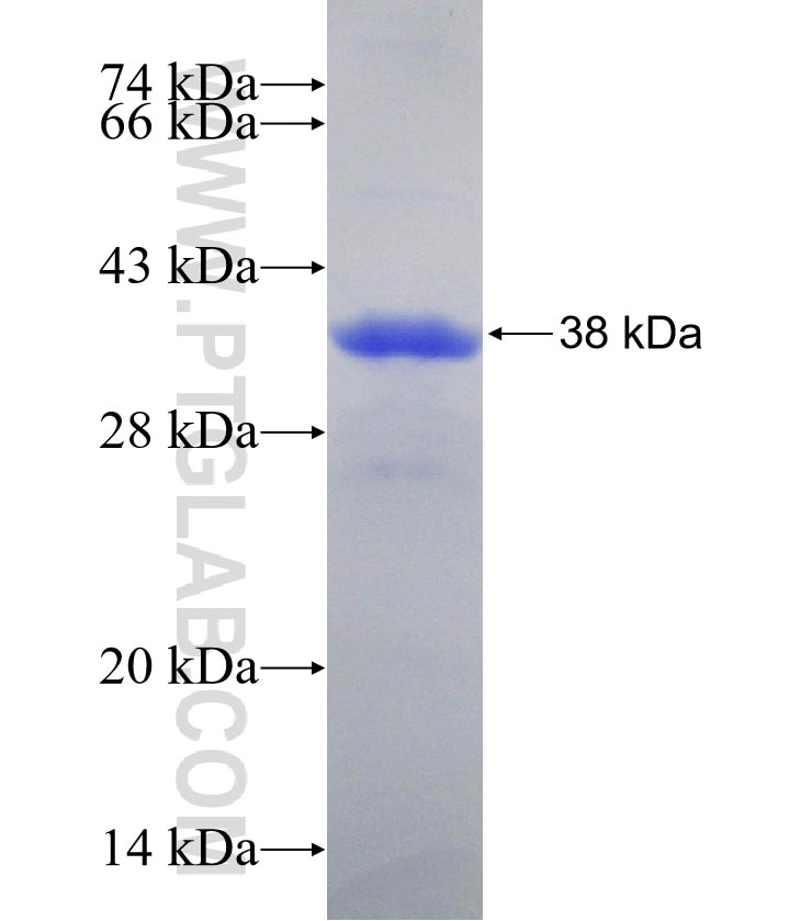 ABHD10 fusion protein Ag18553 SDS-PAGE