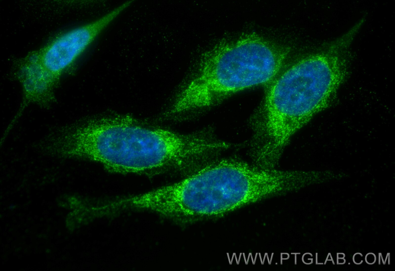 Immunofluorescence (IF) / fluorescent staining of PC-3 cells using ABHD11 Polyclonal antibody (25355-1-AP)