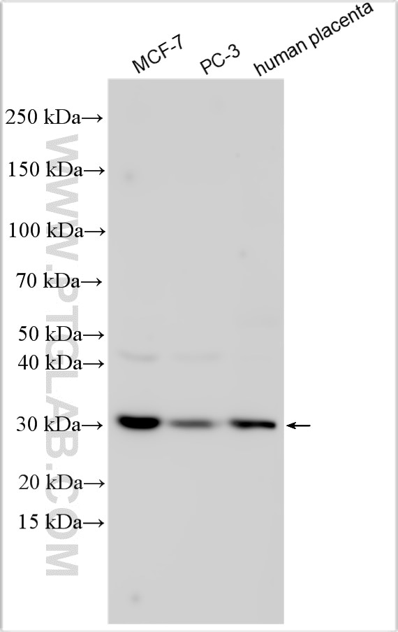 Western Blot (WB) analysis of various lysates using ABHD11 Polyclonal antibody (25355-1-AP)