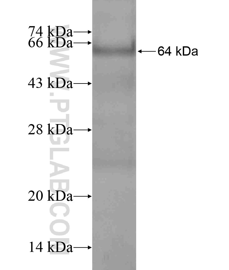 ABHD11 fusion protein Ag18318 SDS-PAGE