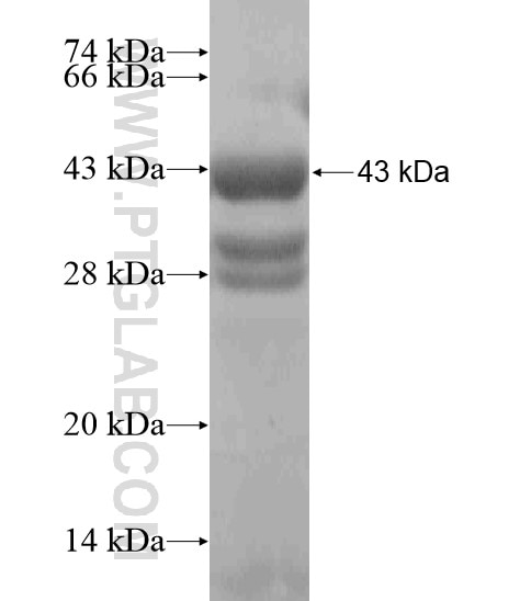 ABHD11 fusion protein Ag19403 SDS-PAGE