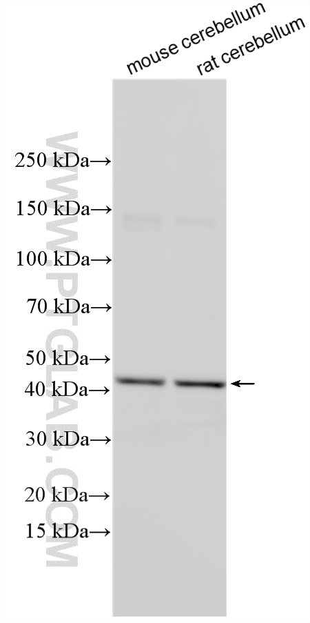 Various lysates were subjected to SDS PAGE followed by western blot with 22660-1-AP (ABHD12 antibody) at dilution of 1:600 incubated at room temperature for 1.5 hours. Western Blot (WB) analysis of various lysates using ABHD12 Polyclonal antibody (22660-1-AP)