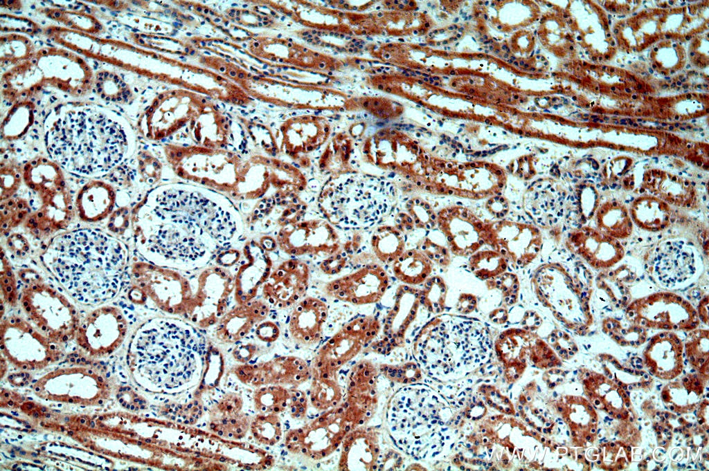 Immunohistochemistry (IHC) staining of human kidney tissue using ABHD12B Polyclonal antibody (20623-1-AP)