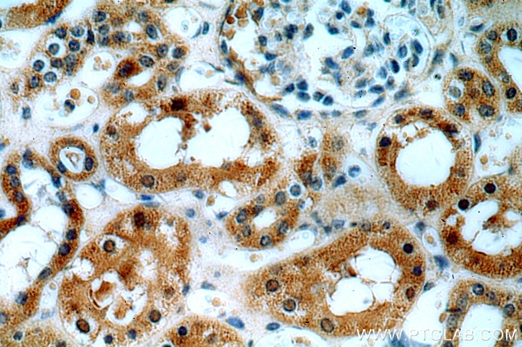 Immunohistochemistry (IHC) staining of human kidney tissue using ABHD12B Polyclonal antibody (20623-1-AP)
