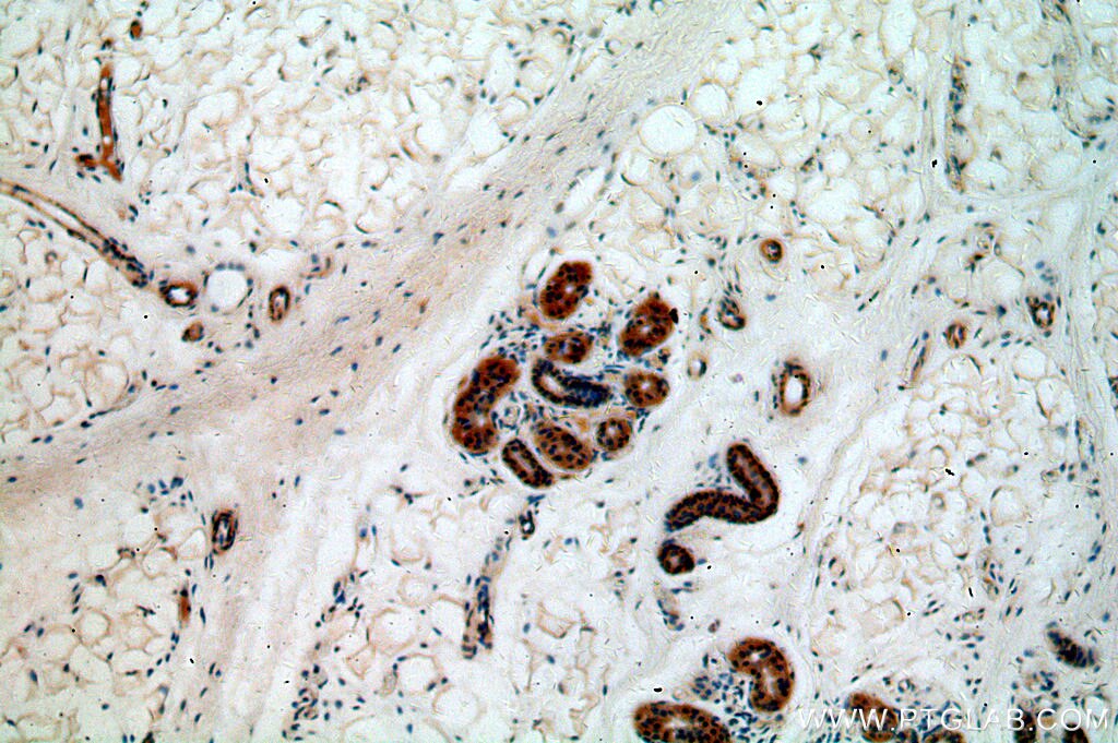 Immunohistochemistry (IHC) staining of human skin tissue using ABHD12B Polyclonal antibody (20623-1-AP)