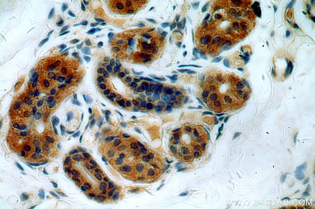 Immunohistochemistry (IHC) staining of human skin tissue using ABHD12B Polyclonal antibody (20623-1-AP)