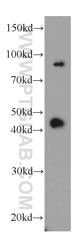 Western Blot (WB) analysis of mouse kidney tissue using ABHD12B Polyclonal antibody (20623-1-AP)