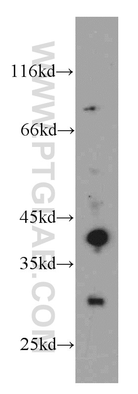 Western Blot (WB) analysis of mouse skin tissue using ABHD12B Polyclonal antibody (20623-1-AP)