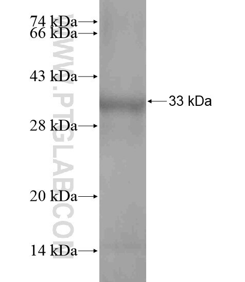 ABHD13 fusion protein Ag18606 SDS-PAGE ABHD13 fusion protein Ag18606 SDS-PAGE