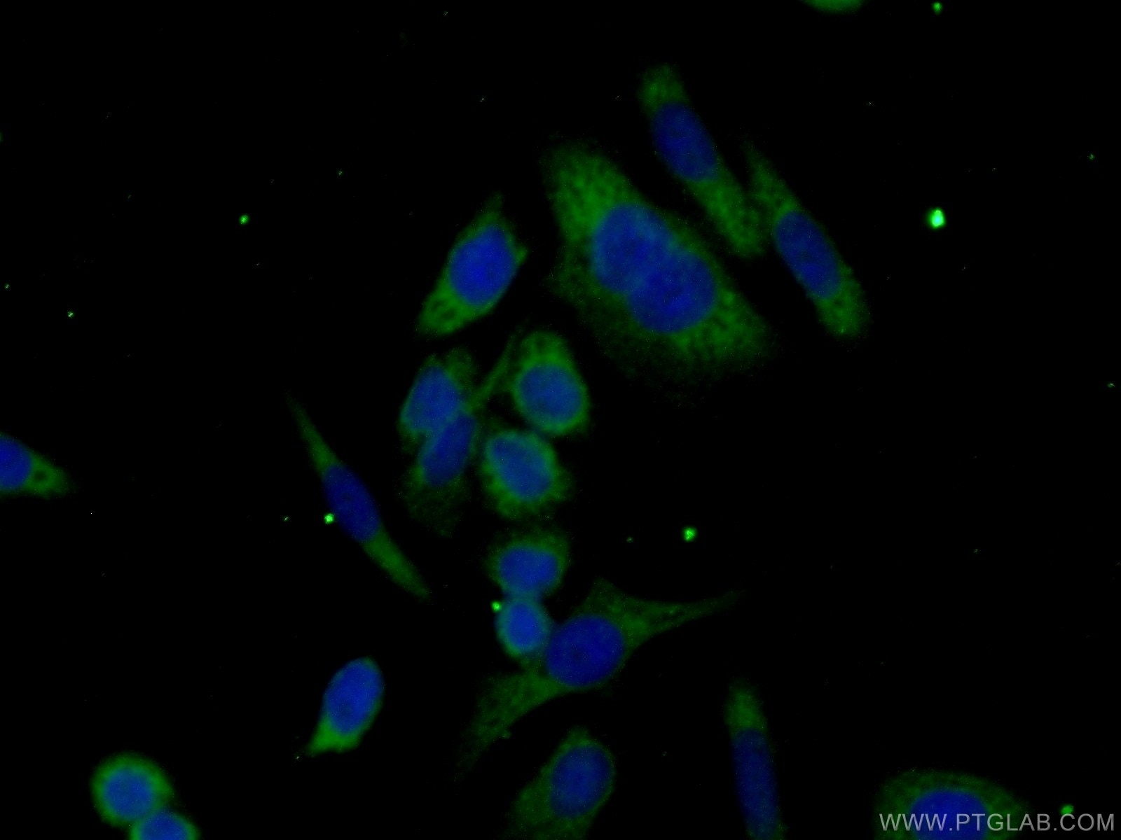 Immunofluorescence (IF) / fluorescent staining of HeLa cells using ABHD14A Polyclonal antibody (19419-1-AP)