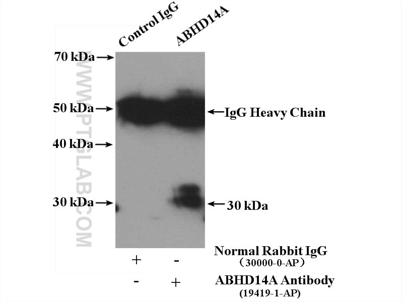 Immunoprecipitation (IP) experiment of mouse kidney tissue using ABHD14A Polyclonal antibody (19419-1-AP)