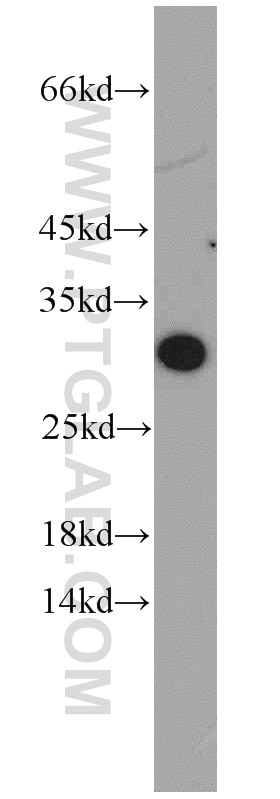 Western Blot (WB) analysis of mouse kidney tissue using ABHD14A Polyclonal antibody (19419-1-AP)