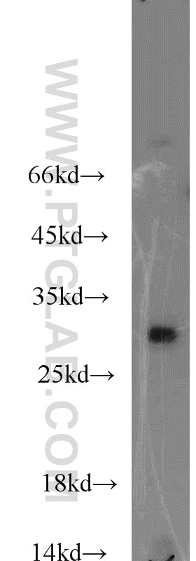 Western Blot (WB) analysis of mouse kidney tissue using ABHD14A Polyclonal antibody (19419-1-AP)