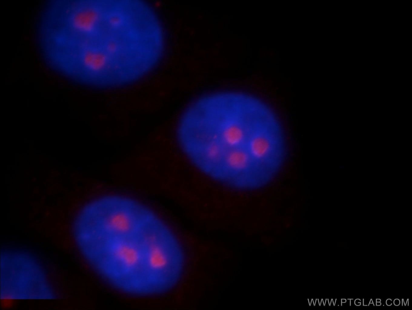 Immunofluorescence (IF) / fluorescent staining of HepG2 cells using ABHD14B Polyclonal antibody (20952-1-AP)