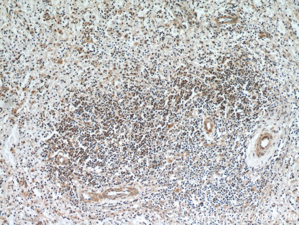 Immunohistochemistry (IHC) staining of human spleen tissue using ABHD14B Polyclonal antibody (20952-1-AP)