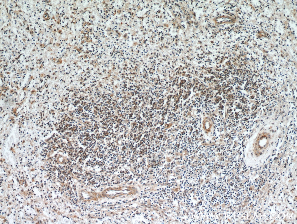 IHC staining of human spleen using 20952-1-AP