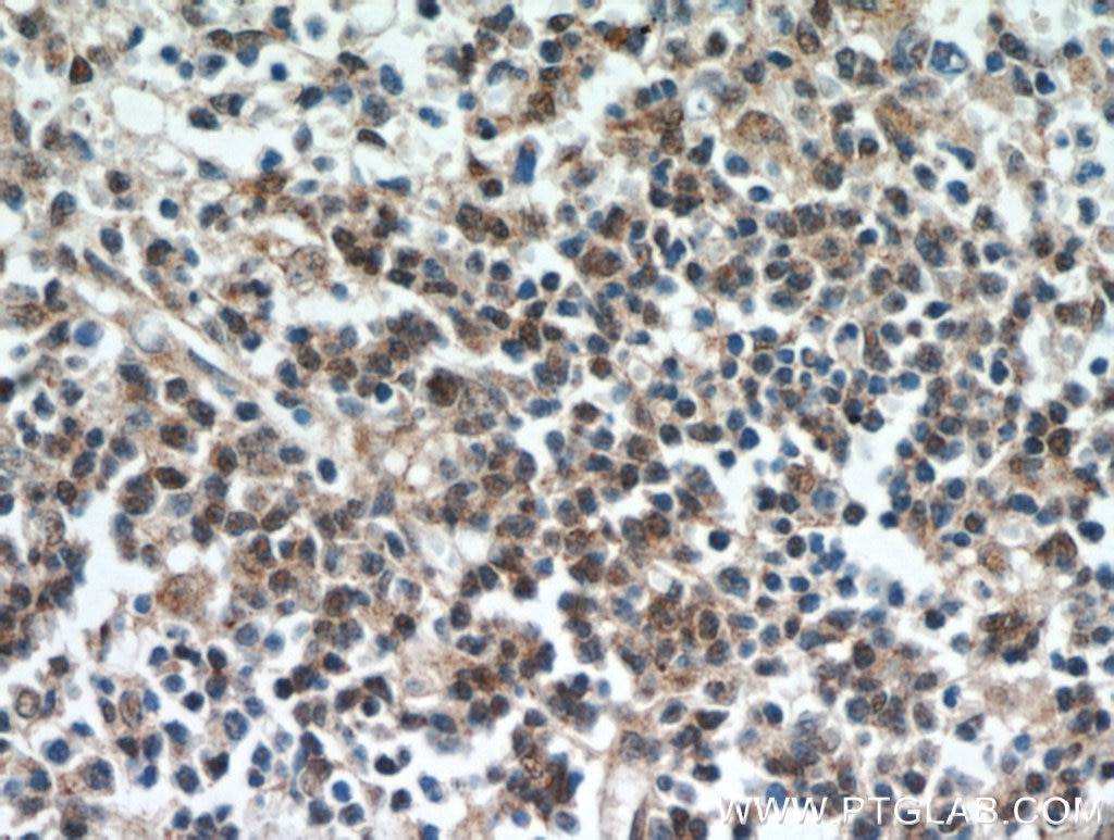 Immunohistochemistry (IHC) staining of human spleen tissue using ABHD14B Polyclonal antibody (20952-1-AP)