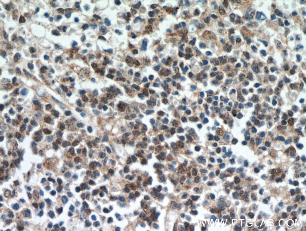 IHC staining of human spleen using 20952-1-AP