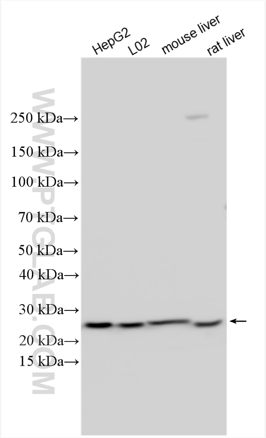 Western Blot (WB) analysis of various lysates using ABHD14B Polyclonal antibody (20952-1-AP)