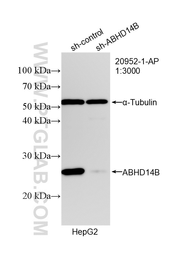 Western Blot (WB) analysis of HepG2 cells using ABHD14B Polyclonal antibody (20952-1-AP)