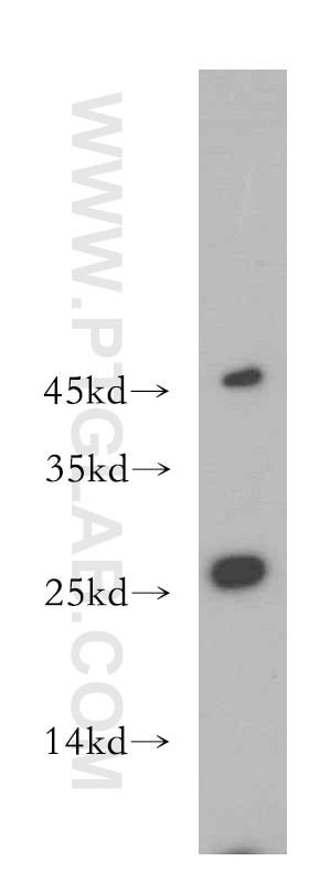 Western Blot (WB) analysis of mouse small intestine tissue using ABHD14B Polyclonal antibody (20952-1-AP)