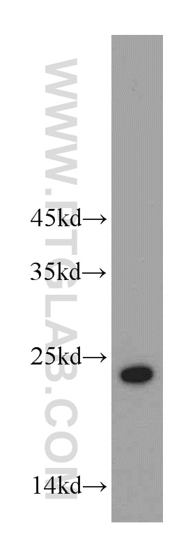 WB analysis of L02 using 20952-1-AP