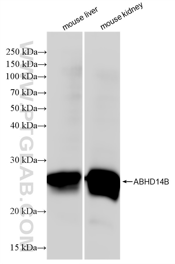 Western Blot (WB) analysis of various lysates using ABHD14B Recombinant monoclonal antibody (87389-1-RR)