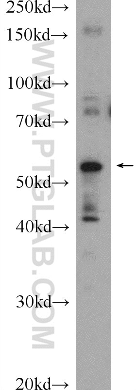 Western Blot (WB) analysis of mouse lung tissue using ABHD15 Polyclonal antibody (22526-1-AP)