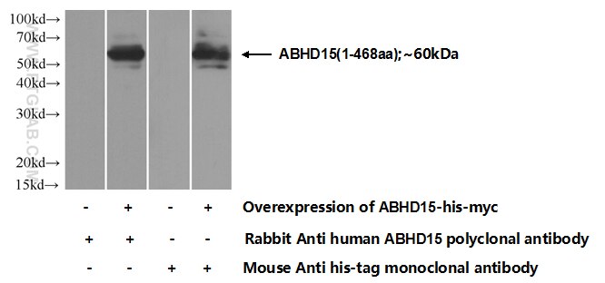 Western Blot (WB) analysis of Transfected HEK-293 cells using ABHD15 Polyclonal antibody (22526-1-AP)