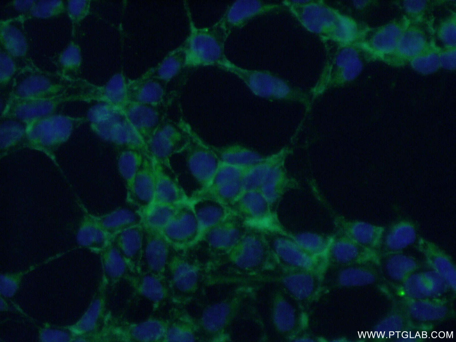 Immunofluorescence (IF) / fluorescent staining of HEK-293 cells using ABHD2 Polyclonal antibody (14039-1-AP)