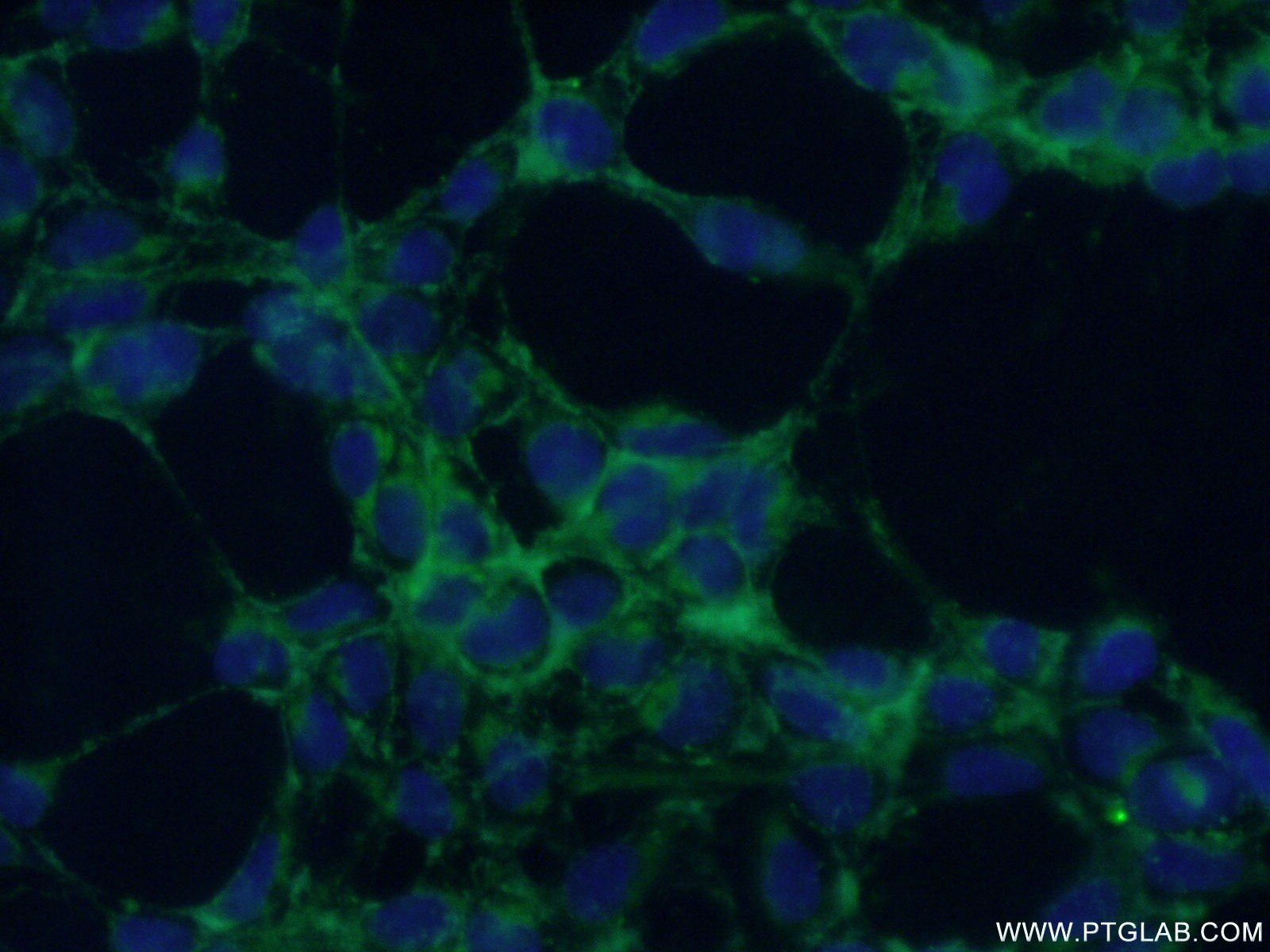 IF Staining of HEK-293 using 14039-1-AP