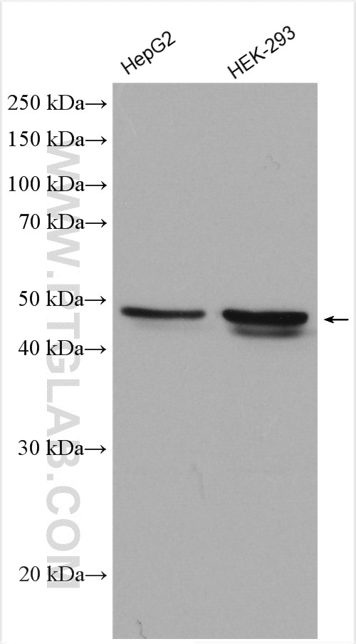 Western Blot (WB) analysis of various lysates using ABHD2 Polyclonal antibody (14039-1-AP)