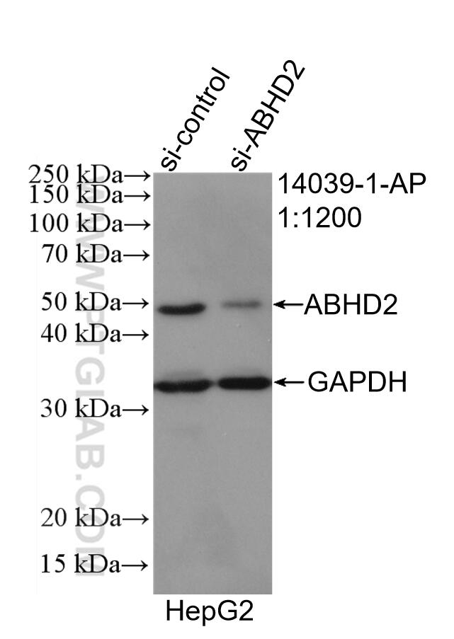 Western Blot (WB) analysis of HepG2 cells using ABHD2 Polyclonal antibody (14039-1-AP)