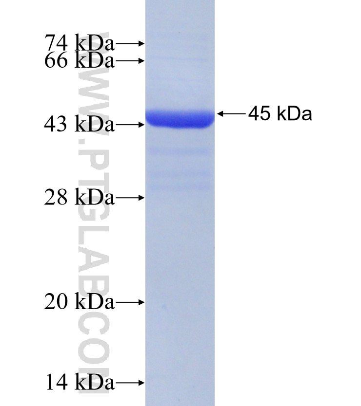 ABHD2 fusion protein Ag31480 SDS-PAGE ABHD2 fusion protein Ag31480 SDS-PAGE