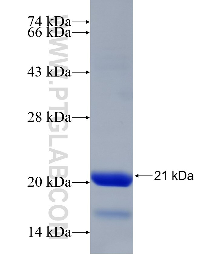 ABHD2 fusion protein Ag31494 SDS-PAGE