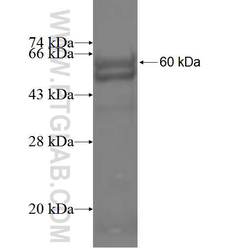 ABHD2 fusion protein Ag5108 SDS-PAGE