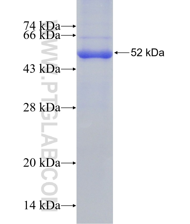 ABHD3 fusion protein Ag18550 SDS-PAGE